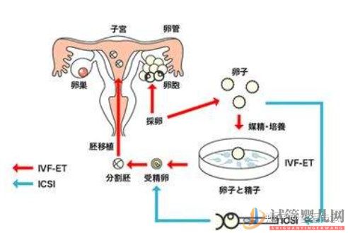 最全面详解_试管婴儿具体流程(试管婴儿可以单方面做吗)