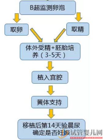 最全面详解_试管婴儿具体流程(试管婴儿可以单方面做吗)