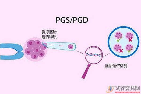 全面解读一代、二代、三代试管婴儿的区别(图4)