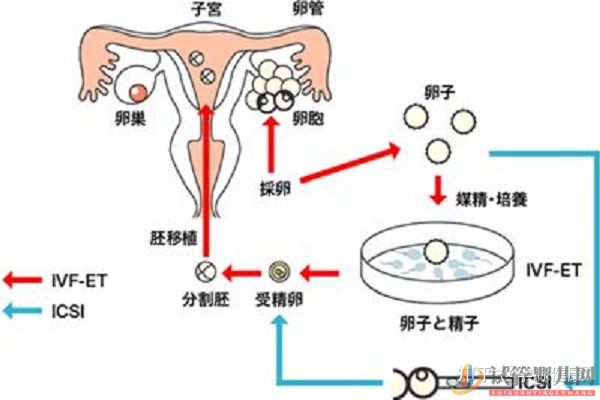 试管婴儿和普通的婴儿长大后啥区别_我国的首例试管 多囊卵巢能怀上孩子吗(图1)