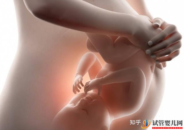 广州试管婴儿多少钱一次_为什么医生不建议做双胞胎(图3)