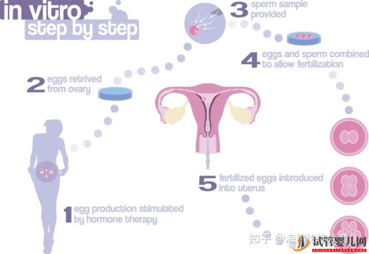 试管婴儿网:试管婴儿1代、2代、3代、4代哪个最好(图1)