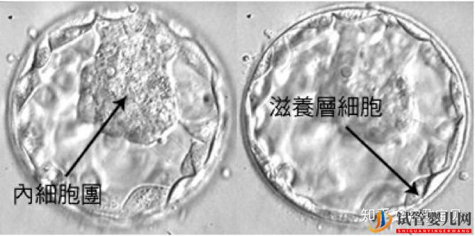 试管婴儿网:3分钟教你看懂胚胎等级报告(图5)