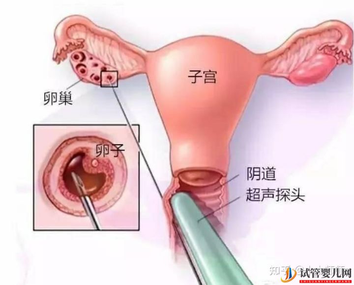 试管婴儿流程&费用(图4)