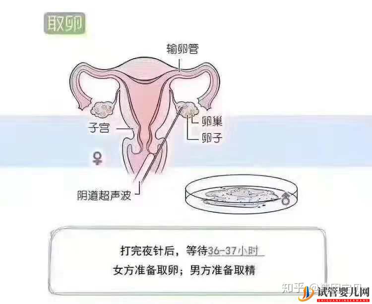 试管婴儿流程图,拿走不谢(图7)