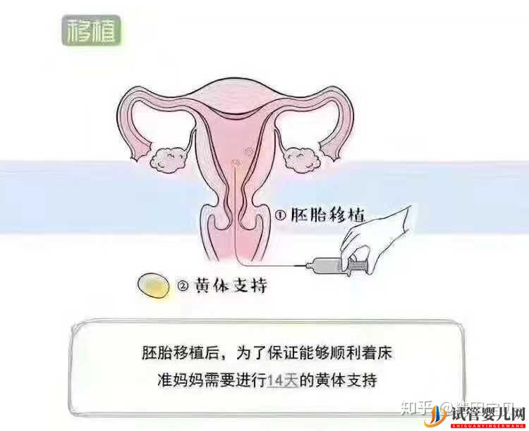 试管婴儿流程图,拿走不谢(图11)