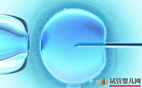 什么是试管受精试管受精的具体步骤有哪些(图1) 什么是试管受精试管受精的具体步骤有哪些(图1)