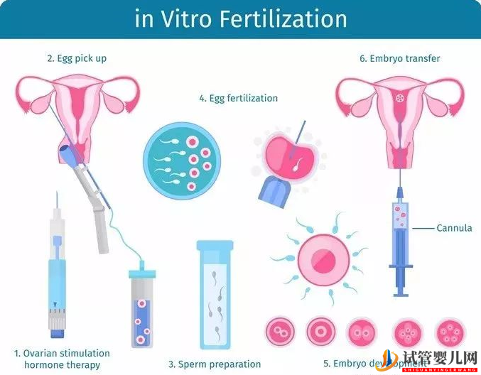 做试管婴儿一个周期大概需要多久_(图2)