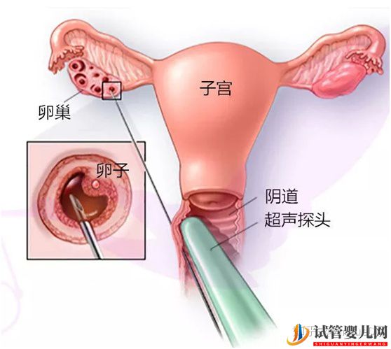 做试管卵泡正常内膜厚度多少才正常_90%的患者不知道(图3)