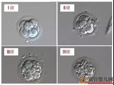 试管婴儿里胚胎碎片是什么呢？(图3)