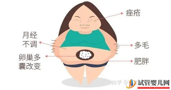 全面!试管婴儿必查项目「性激素六项」报告数值逐个(图17)