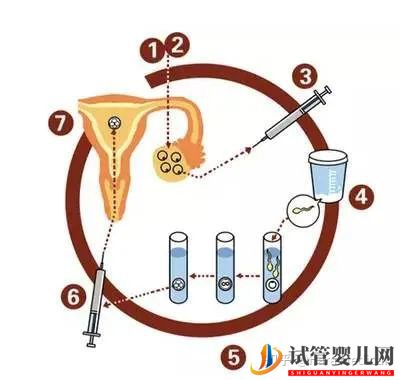 取卵究竟疼不疼呢_听听原孕中心的专家们怎么说(图4)