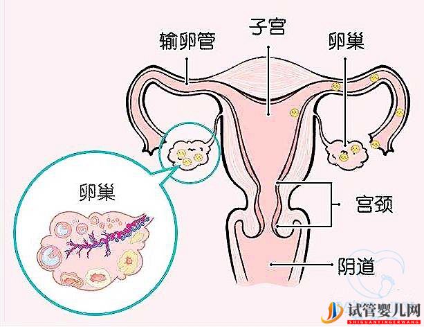 排卵障碍能做试管婴儿吗？成功率多少？(图1)