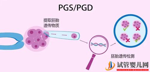 探索美国试管婴儿费用清单(图3)