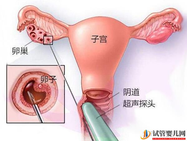 美国试管专家提高试管成功率的有效方案(图7)