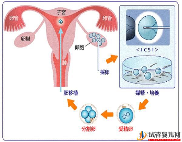 美国试管专家讲解_人工授精和试管婴儿的区别(图5)