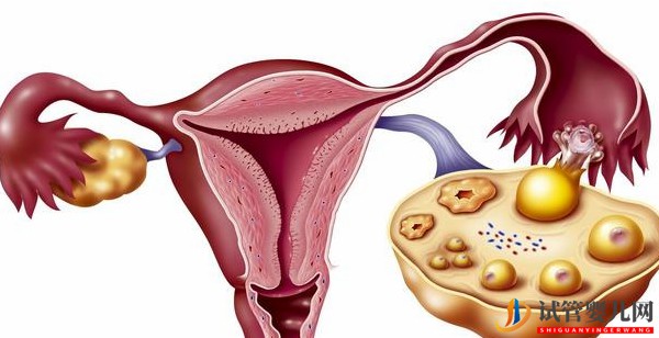 解惑：美国试管婴儿会导致卵巢功能加速衰退吗？(图2)