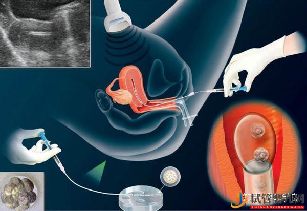 美国试管婴儿技术剖析-六个环节操作细节解读(图9)