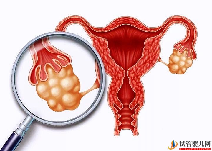 试管促排取不到卵子是怎么回事？试管婴儿促排卵的相关科普(图1)