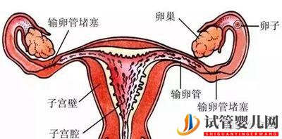 输卵管堵塞还想怀宝宝!能够做泰国试管婴儿吗(图2)