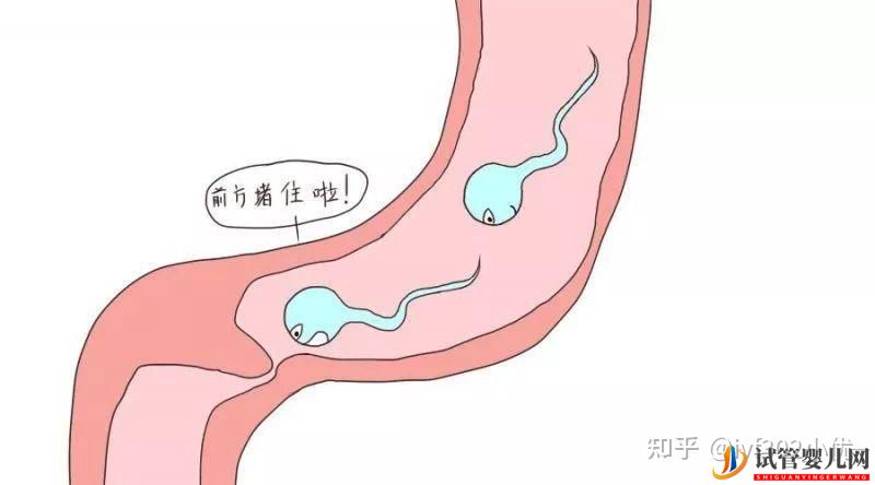 输卵管堵塞想做试管婴儿,拿到结果后我哭了(图4)