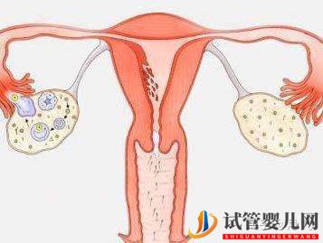 试管婴儿超详细全流程(图6)