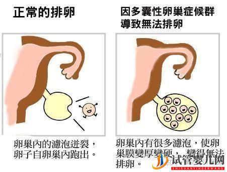 试管婴儿成功诞生有多难(图5)