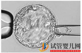 第三代试管婴儿真的最好最先进吗_国内哪里可以做(图5)