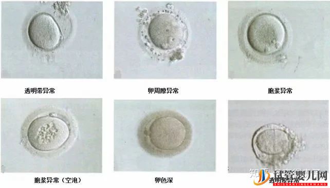 试管婴儿网:夫妻染色体正常,但胚胎染色体异常,什么原因引起(图10)