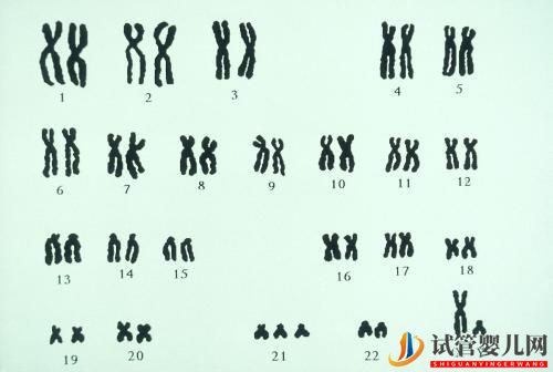 试管婴儿网:夫妻染色体正常，试管胚胎染色体异常的三个原因你都知道吗？(图2)