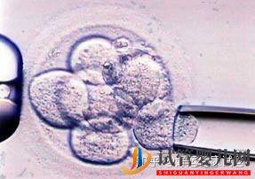 试管婴儿网:好运健康三代试管知男女的必经之路—胚胎活检术(图3)