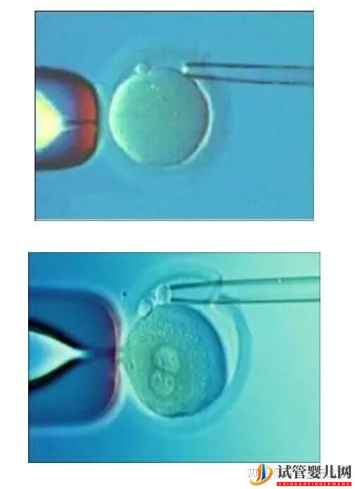 试管婴儿网:好运健康三代试管知男女的必经之路—胚胎活检术(图2)