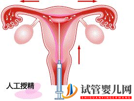 试管婴儿网:不孕，试管婴儿和人工授精应该选择哪一个？(图5)