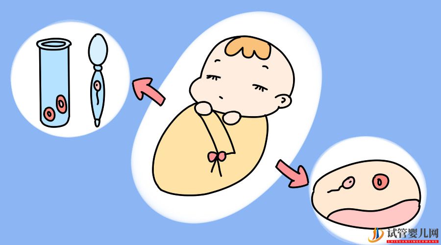 试管婴儿网:做试管婴儿会痛吗？需要打麻醉吗？(图2)
