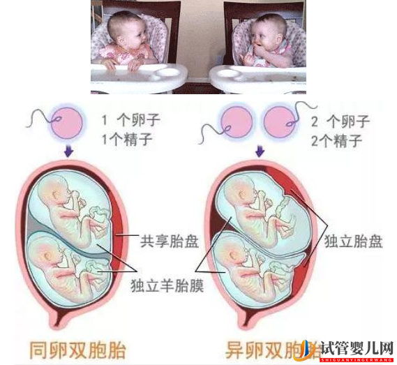 试管婴儿网:哪类人更容易生双胞胎呢？做试管双胞胎包成功行吗？(图1)