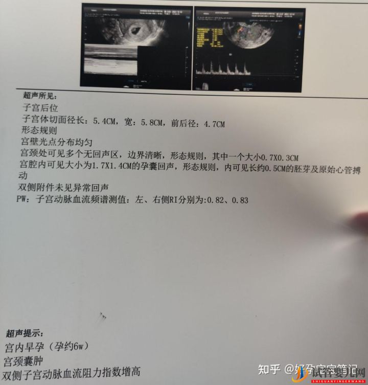 试管婴儿网:25岁就走上非常艰辛的试管婴儿求子之路,感恩志愿者(图4)