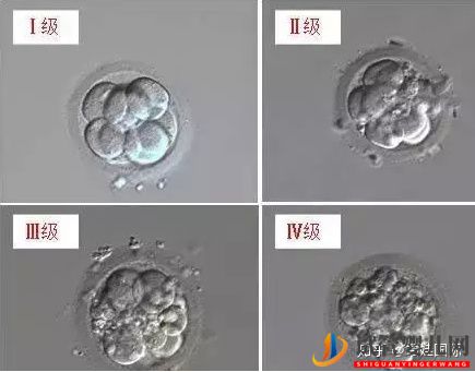 试管婴儿网:44岁人工授精成功率有多少_做到这3点,好孕找上门(图5)