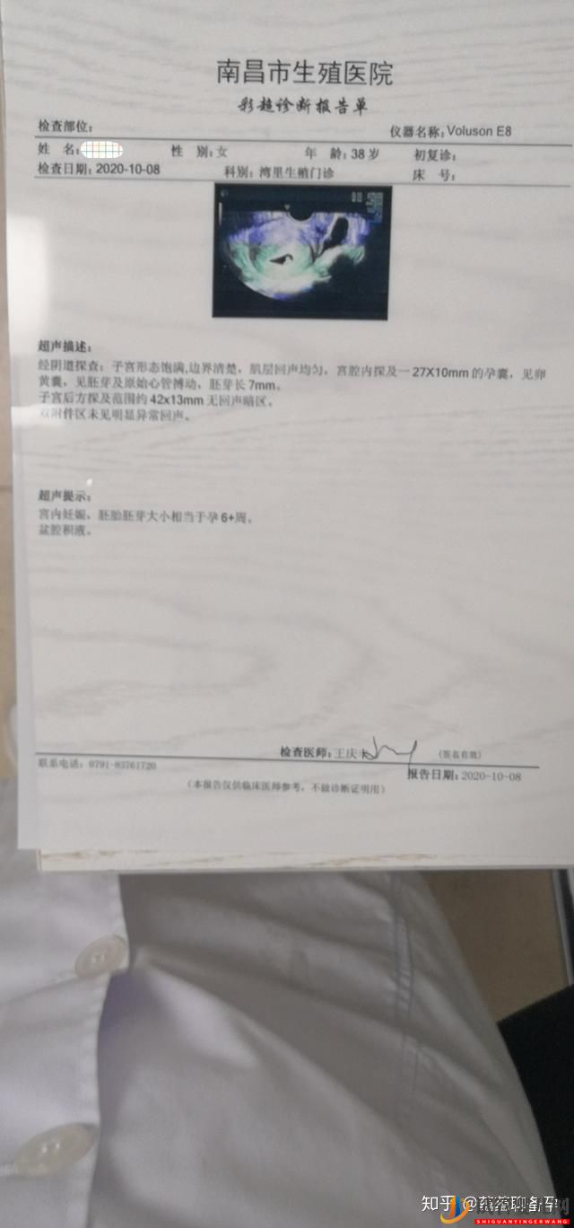 试管婴儿网:分享四例高龄试管成功案例,最大的45岁,给高龄孕妈(图16)