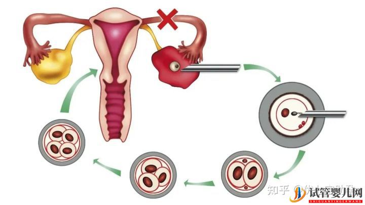 试管婴儿网:全面解析第三代试管婴儿的科普知识(图22)