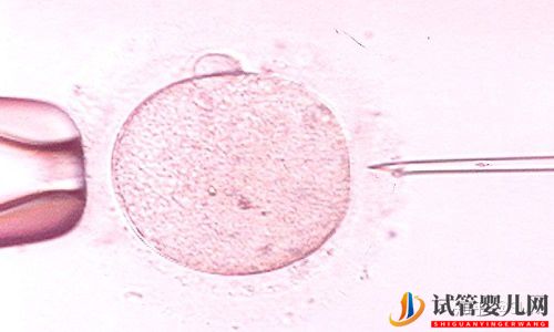 试管婴儿网:试管婴儿与自然受孕截然不同(图5)