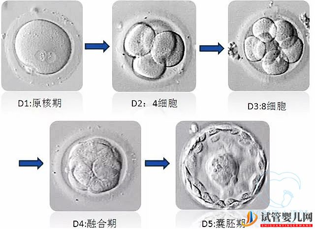 试管婴儿网:试管婴儿冻胚和鲜胚哪个成功率高(图1)