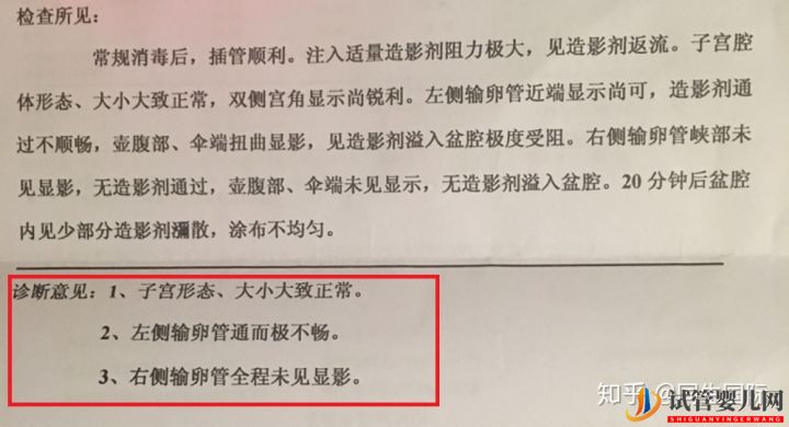 试管婴儿网:女人做了试管人就废了其中的辛酸苦不堪言,但我不...(图2)