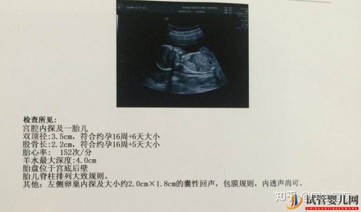 试管婴儿网:女人做了试管人就废了其中的辛酸苦不堪言,但我不...(图3)