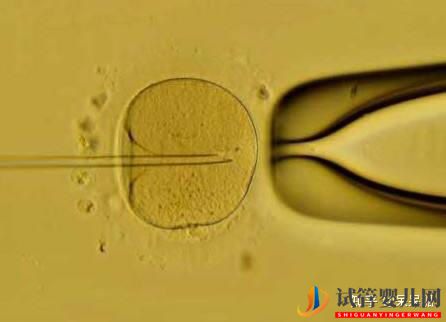 试管婴儿网:试管过程中影响成功率的关键是什么,鲜胚、冻胚、囊...(图7)