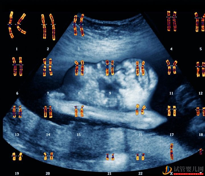 为什么会连续出现胚胎染色体问题,如何避免(图5)