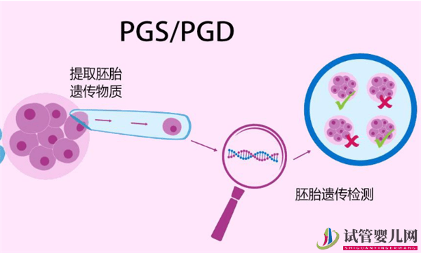 为什么很多人选择去俄罗斯做试管婴儿呢(图1)