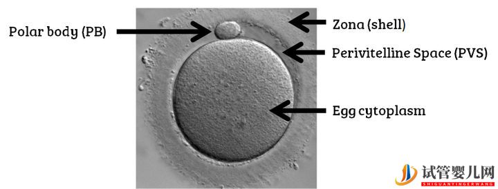 试管婴儿网:试管婴儿卵子质量完整指南-卵子质量完整攻略(图1)