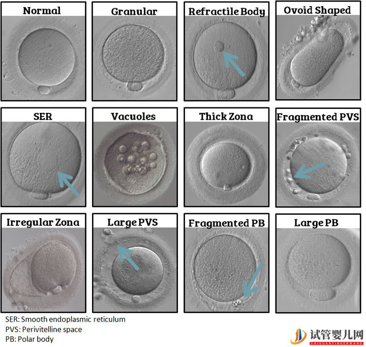 试管婴儿网:试管婴儿卵子质量完整指南-卵子质量完整攻略(图3)