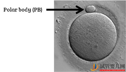 试管婴儿网:试管婴儿卵子质量完整指南-卵子质量完整攻略(图12)