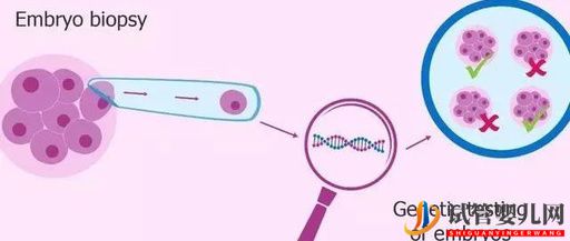 第三代试管婴儿到底能解决什么遗传性疾病？(图1)